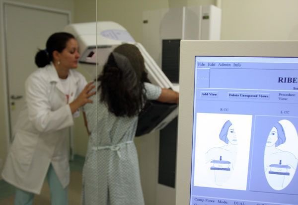 Mulheres podem marcar mamografia em unidade móvel - Foto: Divulgação