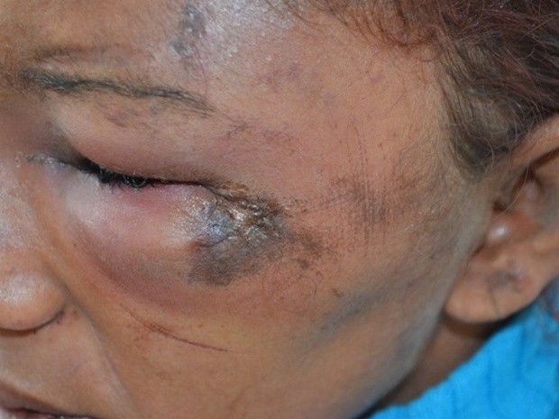 Crimes contra mulheres aumentam mais de 80% em Araçatuba - Mulher foi torturada e espancada pelo marido em Araçatuba (Foto: Reprodução / TV Tem)